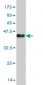 GLP2R Antibody (monoclonal) (M05)