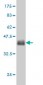 GLUL Antibody (monoclonal) (M02)