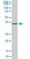 GLUL Antibody (monoclonal) (M02)