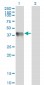 GLUL Antibody (monoclonal) (M02)