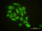 GMFB Antibody (monoclonal) (M01)