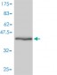 GMFB Antibody (monoclonal) (M01)