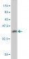 GMPS Antibody (monoclonal) (M01)