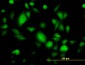 GNB3 Antibody (monoclonal) (M01)