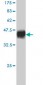 GPR24 Antibody (monoclonal) (M01)