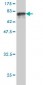 GPT Antibody (monoclonal) (M03)