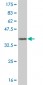 GRM7 Antibody (monoclonal) (M01)