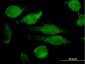 GRN Antibody (monoclonal) (M01)