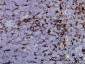 GSN Antibody (monoclonal) (M01)