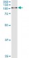 GSN Antibody (monoclonal) (M01)