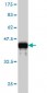 GSN Antibody (monoclonal) (M01)