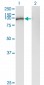 GSN Antibody (monoclonal) (M01)