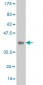 GSR Antibody (monoclonal) (M01)