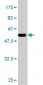 GSTA1 Antibody (monoclonal) (M01)