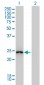 GSTA1 Antibody (monoclonal) (M01)