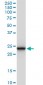 GSTA1 Antibody (monoclonal) (M08)