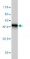 GSTA3 Antibody (monoclonal) (M01)