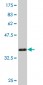 GSTM4 Antibody (monoclonal) (M01)