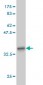 GSTO1 Antibody (monoclonal) (M01)