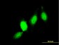 GSTP1 Antibody (monoclonal) (M01)