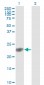 GSTP1 Antibody (monoclonal) (M01)