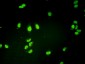 GTF2H1 Antibody (monoclonal) (M01)