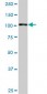 GTF3C3 Antibody (monoclonal) (M01)