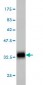 GYG1 Antibody (monoclonal) (M07)