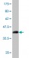 GYG1 Antibody (monoclonal) (M08)