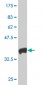 HAND2 Antibody (monoclonal) (M06)