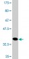 HAPLN4 Antibody (monoclonal) (M12)