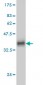 HARS Antibody (monoclonal) (M01)