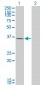 HAVCR1 Antibody (monoclonal) (M02)