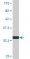 HAX1 Antibody (monoclonal) (M04)