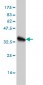 HBB Antibody (monoclonal) (M01)