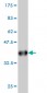 HBB Antibody (monoclonal) (M02)