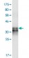 HCRTR2 Antibody (monoclonal) (M01)