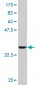 HD Antibody (monoclonal) (M02)