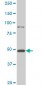 HD Antibody (monoclonal) (M11)