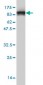 HDAC1 Antibody (monoclonal) (M06)