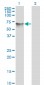 HDAC1 Antibody (monoclonal) (M06)