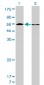 HDAC1 Antibody (monoclonal) (M14)