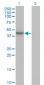 HDAC11 Antibody (monoclonal) (M01)