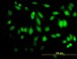 HDAC5 Antibody (monoclonal) (M01)