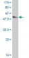 HDAC7A Antibody (monoclonal) (M01)
