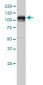 HDAC7A Antibody (monoclonal) (M01)