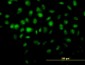 HDAC8 Antibody (monoclonal) (M01)