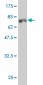 HDAC8 Antibody (monoclonal) (M01)