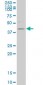 HDAC8 Antibody (monoclonal) (M01)