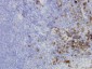 HERPUD1 Antibody (monoclonal) (M04)